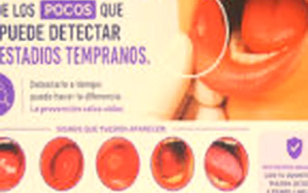 Exploración autoguiada y visitas dentales, fundamentales frente a cáncer bucal